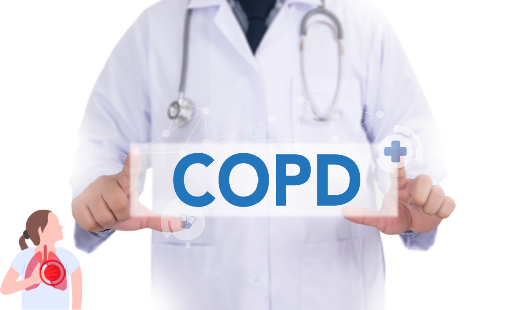 ICD-10 Code J44.9 for COPD Management